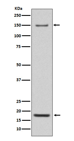 Anti-Integrin alpha 5 Rabbit Polyclonal Antibody