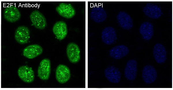Anti-E2F1 Rabbit Polyclonal Antibody