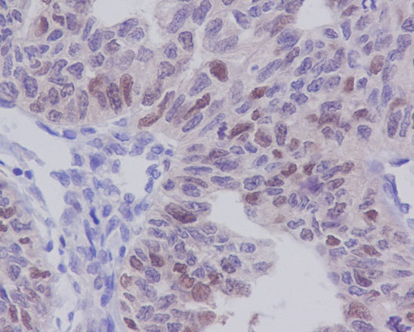 Anti-E2F1 Rabbit Polyclonal Antibody
