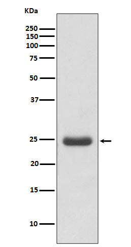 Anti-Thymidine Kinase Rabbit Polyclonal Antibody
