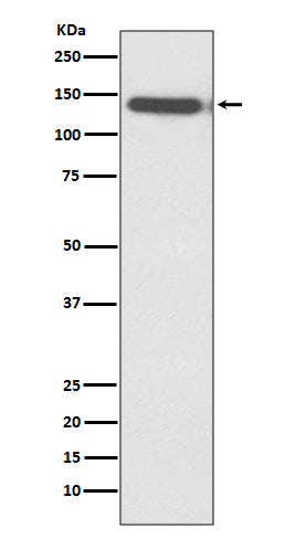 Anti-Ctip2 Rabbit Polyclonal Antibody