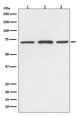 Anti-SDHA Rabbit Polyclonal Antibody