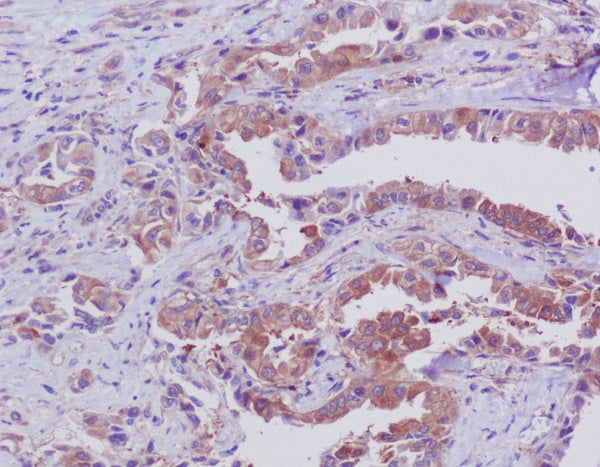 Anti-Bid Rabbit Polyclonal Antibody