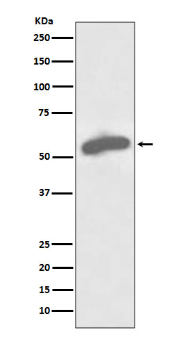 Anti-Glucose 6 Phosphate Dehydrogenase Rabbit Polyclonal Antibody