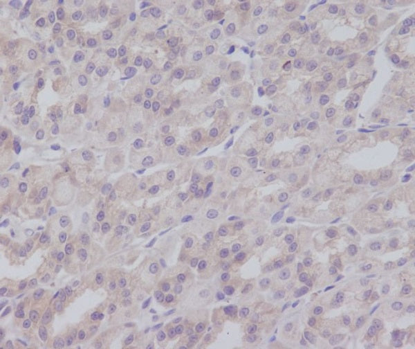 Anti-IKK gamma Rabbit Polyclonal Antibody