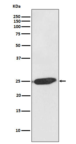 Anti-SNAP25 Rabbit Polyclonal Antibody