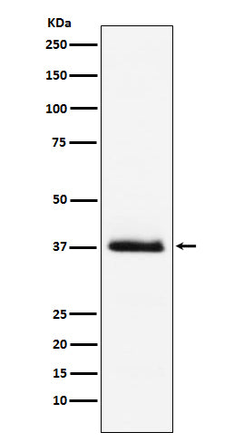 Anti-Parathyroid Hormone Rabbit Polyclonal Antibody
