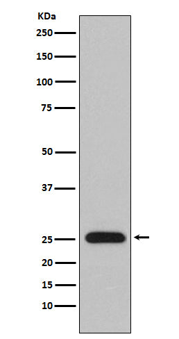 Anti-Lambda Light Chain Rabbit Polyclonal Antibody