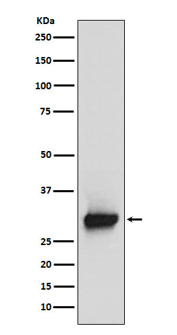 Anti-Calretinin Rabbit Polyclonal Antibody