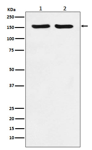 Anti-ROCK2 Rabbit Polyclonal Antibody