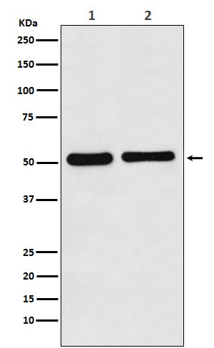 Anti-Fascin Rabbit Polyclonal Antibody