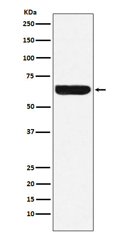 Anti-Placental Alkaline Phosphatase Rabbit Polyclonal Antibody