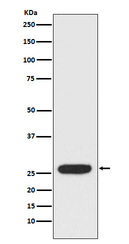 Anti-StAR Rabbit Polyclonal Antibody