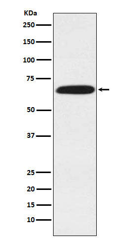 Anti-DDX5 Rabbit Polyclonal Antibody