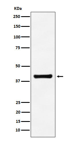 Anti-ALDOA Rabbit Polyclonal Antibody
