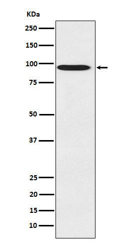 Anti-CDT2 Rabbit Polyclonal Antibody