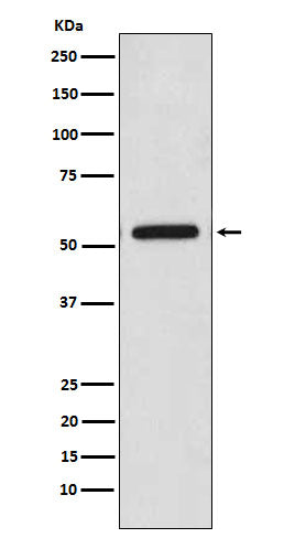 Anti-CaMKII beta Rabbit Polyclonal Antibody