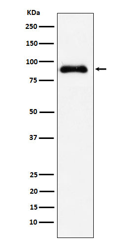 Anti-SATB2 Rabbit Polyclonal Antibody