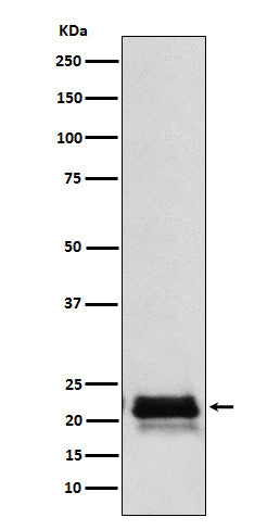 Anti-FSH beta Rabbit Polyclonal Antibody