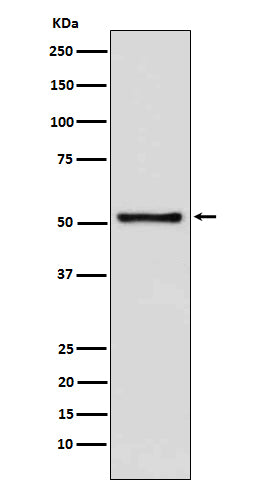 Anti-DNA Nucleotidylexotransferase Rabbit Polyclonal Antibody