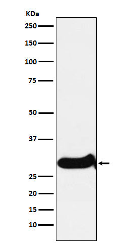 Anti-IGFBP7 Rabbit Polyclonal Antibody