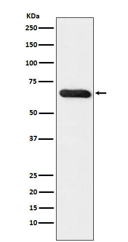 Anti-RBPJK Rabbit Polyclonal Antibody