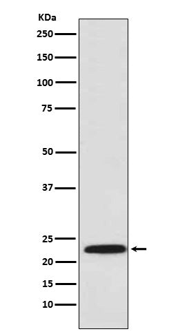 Anti-Proteasome beta 8 Rabbit Polyclonal Antibody