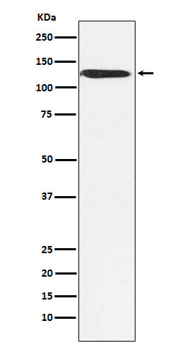 Anti-SMARCA5 Rabbit Polyclonal Antibody