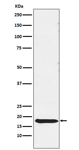 Anti-Thyrotropin Subunit beta Rabbit Polyclonal Antibody
