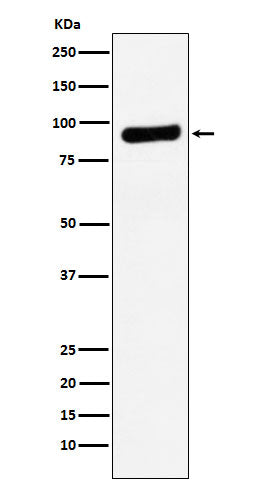 Anti-RRM1 Rabbit Polyclonal Antibody