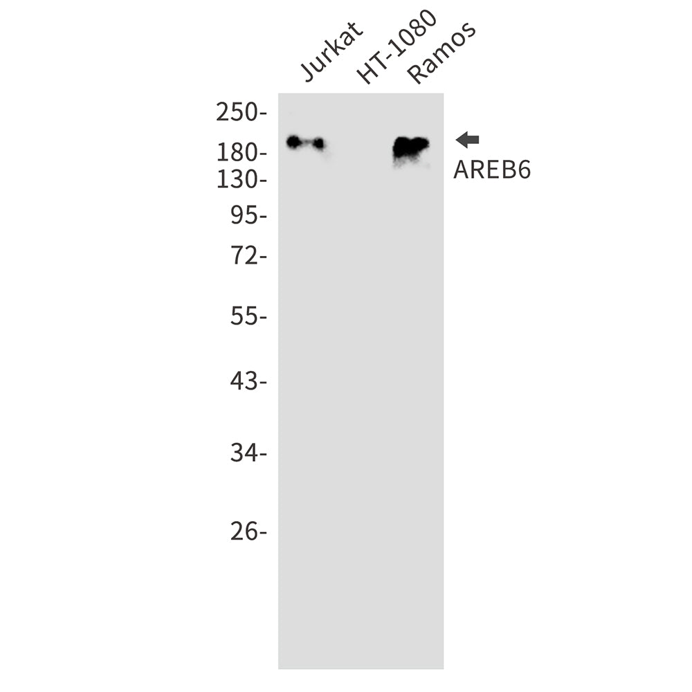 Anti-ZEB1 Rabbit Polyclonal Antibody