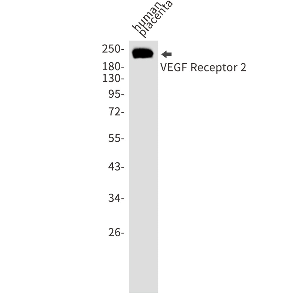Anti-VEGF Receptor 2 Rabbit Polyclonal Antibody