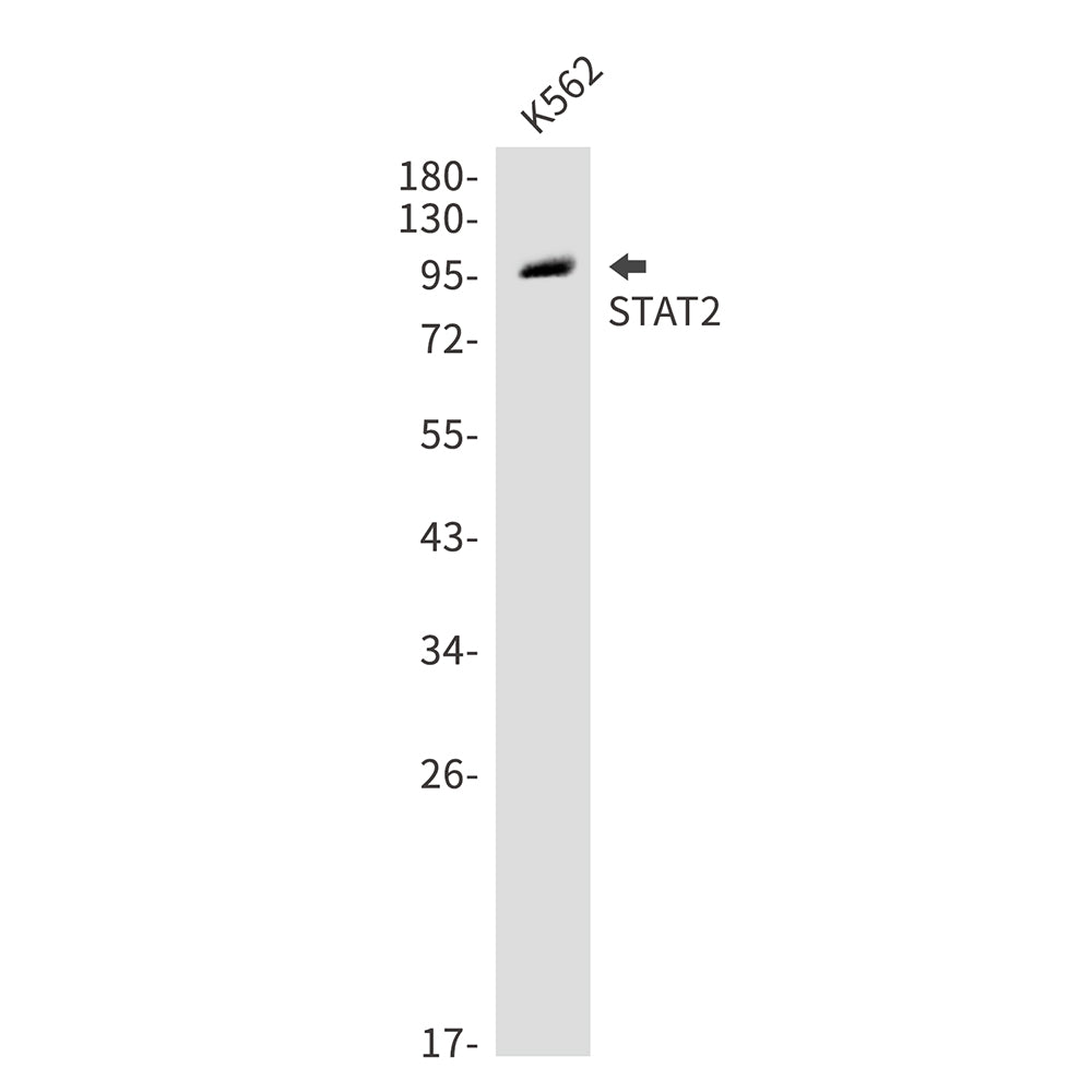 Anti-STAT2 Rabbit Polyclonal Antibody
