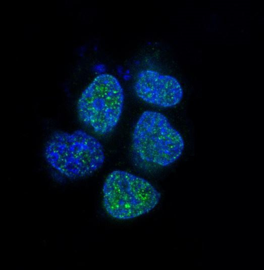 Anti-Androgen Receptor Rabbit Polyclonal Antibody