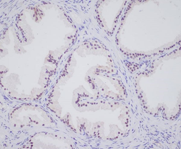 Anti-Androgen Receptor Rabbit Polyclonal Antibody