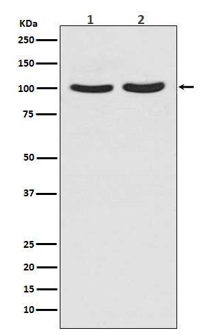 Anti-Androgen Receptor Rabbit Polyclonal Antibody