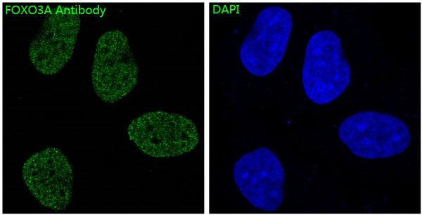 Anti-FOXO3 Rabbit Polyclonal Antibody