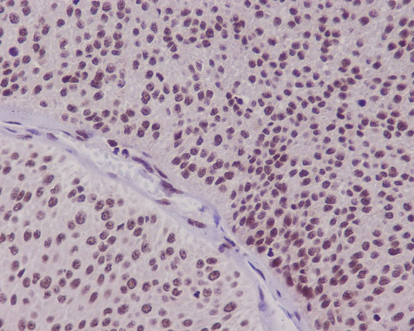 Anti-FOXO3 Rabbit Polyclonal Antibody