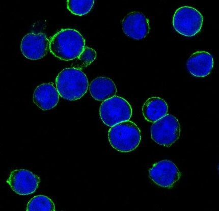 Anti-ErbB 2 Rabbit Polyclonal Antibody