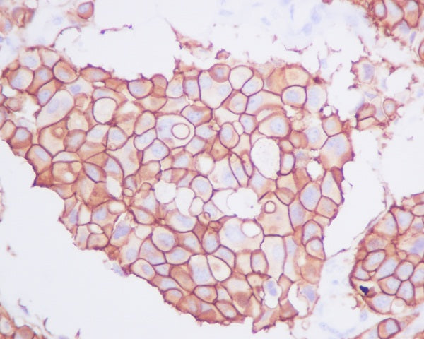 Anti-ErbB 2 Rabbit Polyclonal Antibody