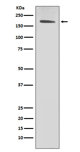 Anti-ErbB 2 Rabbit Polyclonal Antibody