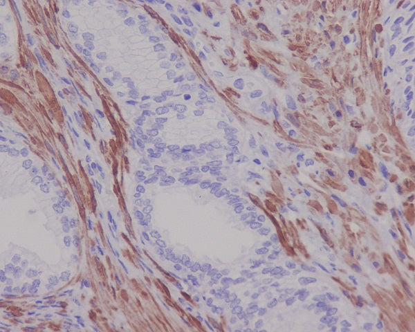 Anti-Desmin Rabbit Polyclonal Antibody