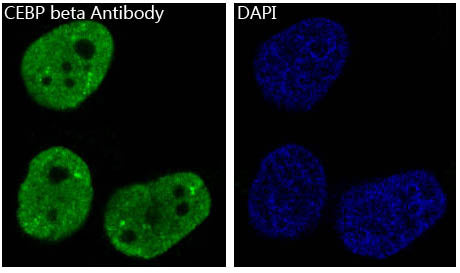 Anti-CEBPB Rabbit Polyclonal Antibody