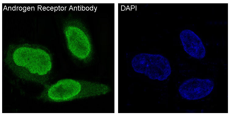 Anti-Androgen Receptor Rabbit Polyclonal Antibody