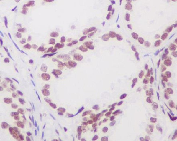 Anti-Androgen Receptor Rabbit Polyclonal Antibody