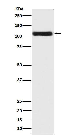 Anti-Androgen Receptor Rabbit Polyclonal Antibody