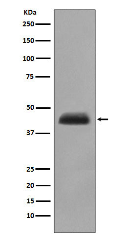 Anti-Cytokeratin 15 Rabbit Polyclonal Antibody