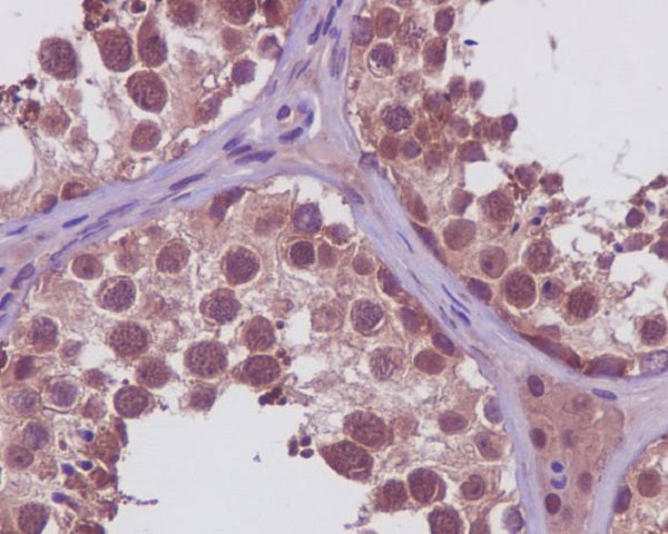 Anti-PRMT5 Rabbit Polyclonal Antibody