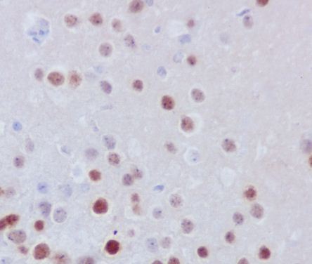 Anti-Fos B Rabbit Polyclonal Antibody