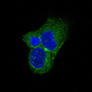 Anti-Tyrosine Hydroxylase Rabbit Polyclonal Antibody